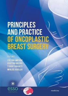 Principles and Practice of Oncoplastic Breast Surgery